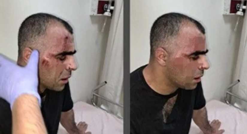 Gazeteciler Derneği’nden kınama